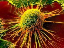 Ученые нашли раковые клетки с 11000-летней историей