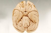 Найдена отвечающая за уникальность человеческого разума зона мозга