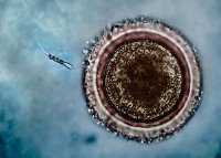 Спиральные «спермаботы» помогут в борьбе с мужским бесплодием