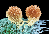Найден новый способ уничтожения раковых клеток