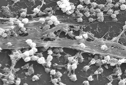 Победить инфекцию, разоружив бактерию Исследователи из Германии сообщают, что они разработали принципиально новый способ борьбы с бактериальными инфекциями, продемонстрировав, что определенные низкомолекулярные соединения понижают болезнетворную способность Staphylococcus aureus.